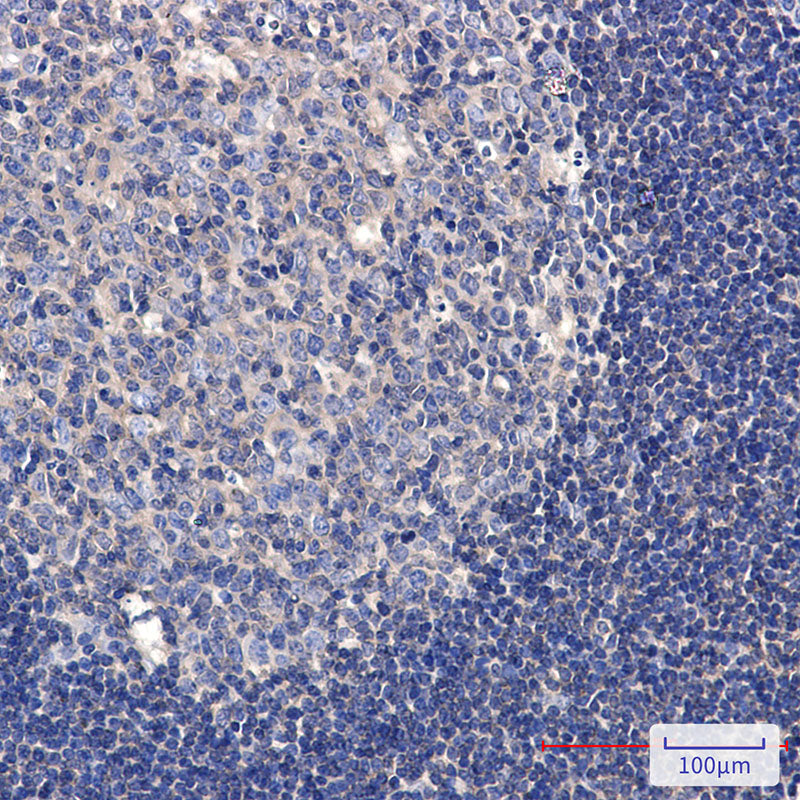 Anti-Phospho-TAOK1/2/3 (Ser181/Ser181/Ser177) Rabbit Monoclonal Antibody