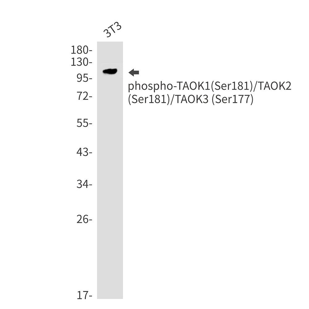Anti-Phospho-TAOK1/2/3 (Ser181/Ser181/Ser177) Rabbit Monoclonal Antibody