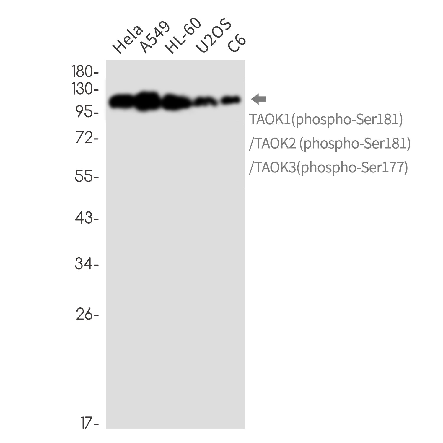 Anti-Phospho-TAOK1/2/3 (Ser181/Ser181/Ser177) Rabbit Monoclonal Antibody