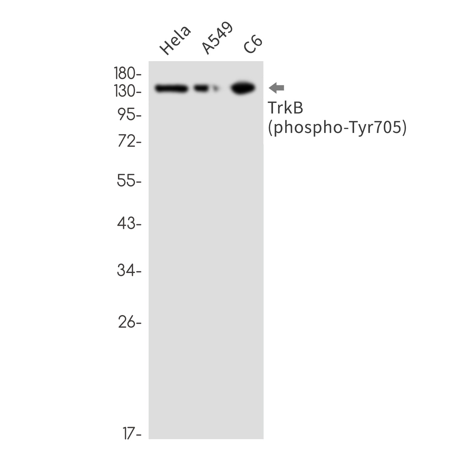 Anti-Phospho-TrkB (Tyr705) Rabbit Monoclonal Antibody