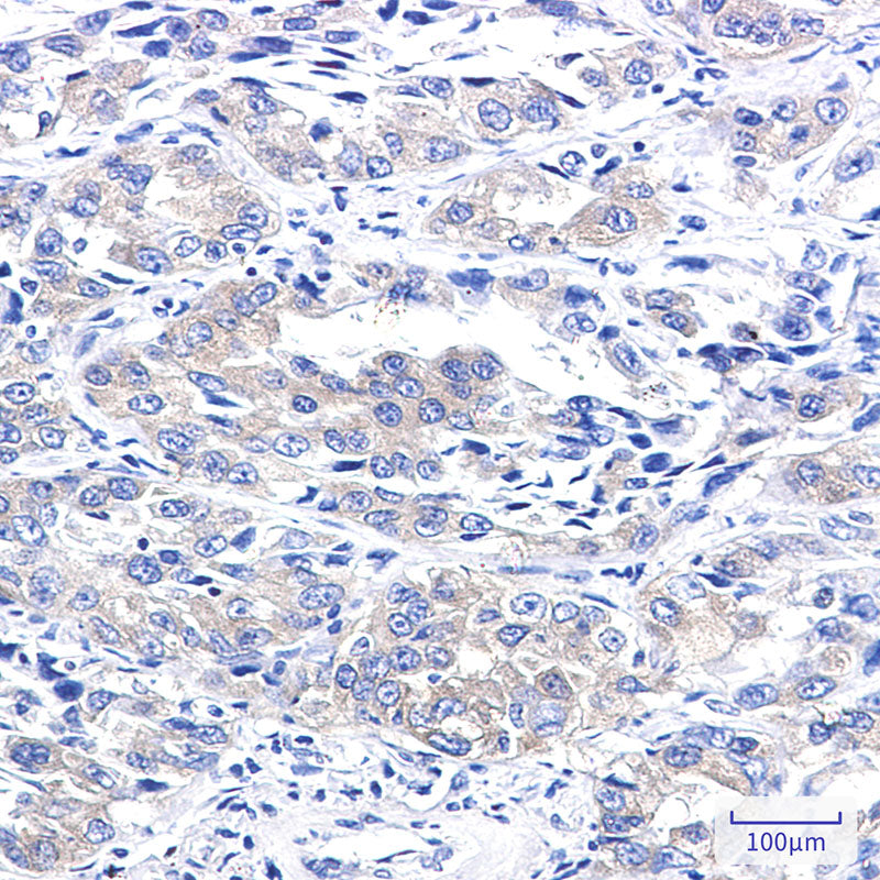 Anti-A RAF Rabbit Monoclonal Antibody