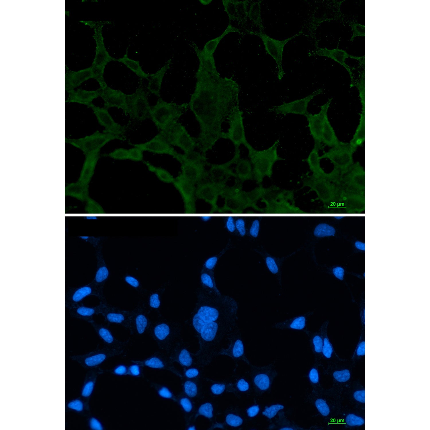 Anti-ACADM Rabbit Monoclonal Antibody