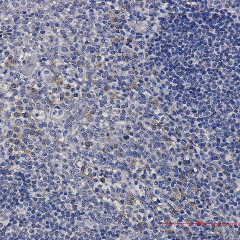 Anti-ACADM Rabbit Monoclonal Antibody