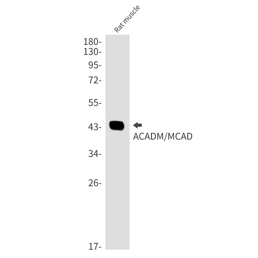 Anti-ACADM Rabbit Monoclonal Antibody