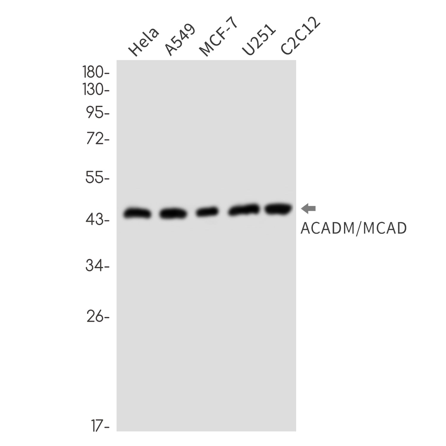 Anti-ACADM Rabbit Monoclonal Antibody