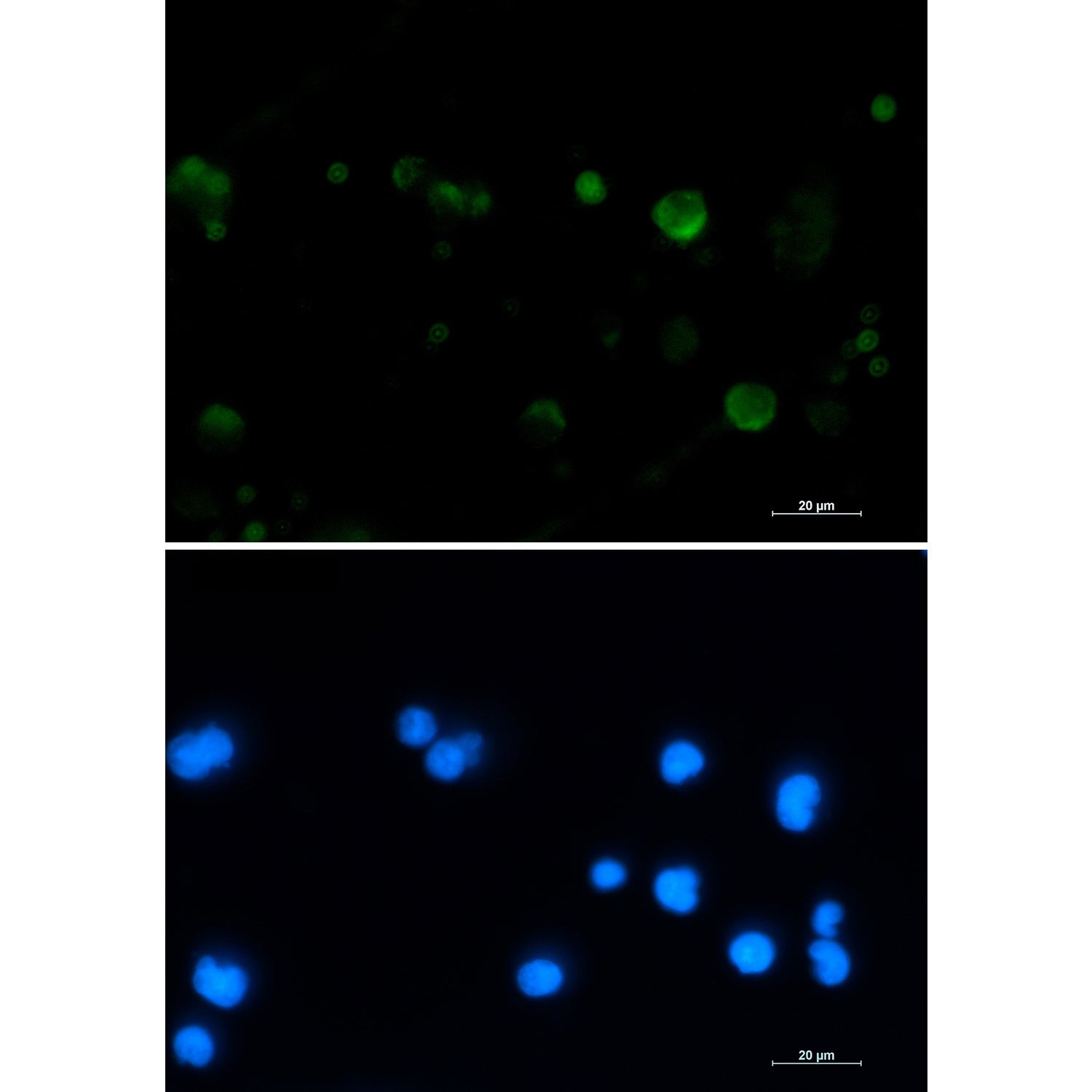 Anti-Aconitase 2 Rabbit Monoclonal Antibody