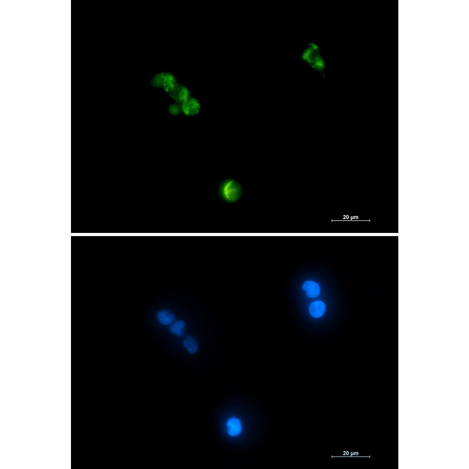 Anti-Aconitase 2 Rabbit Monoclonal Antibody