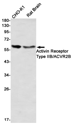Anti-Activin Receptor Type IIB Rabbit Monoclonal Antibody