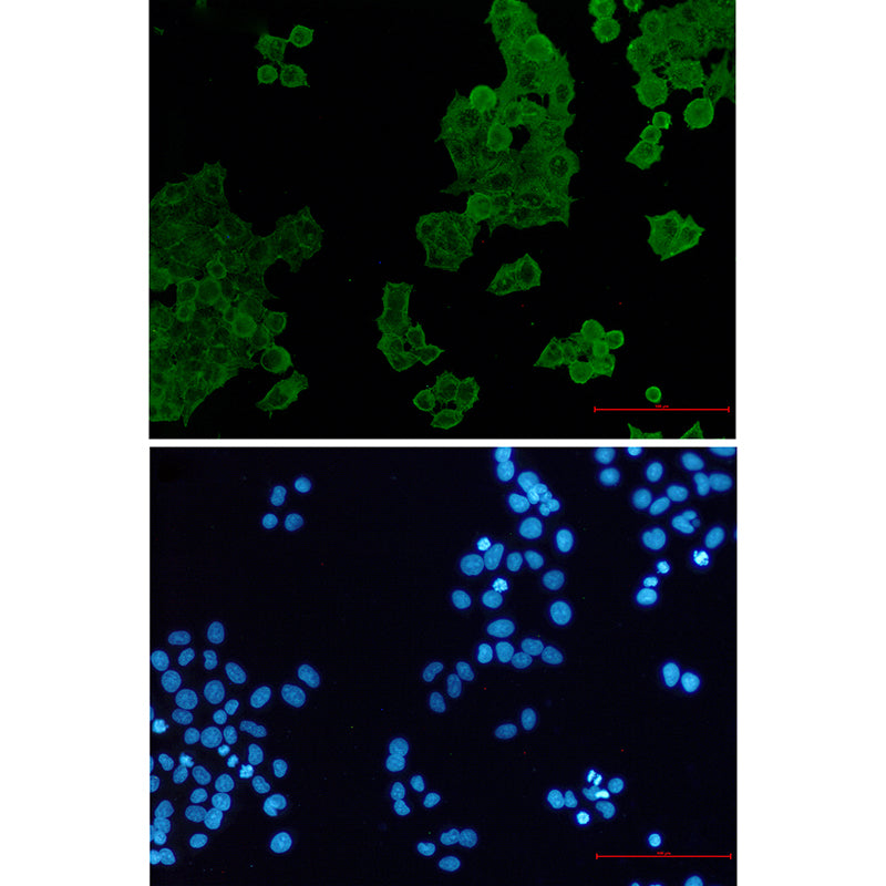 Anti-ACTR1B Rabbit Monoclonal Antibody