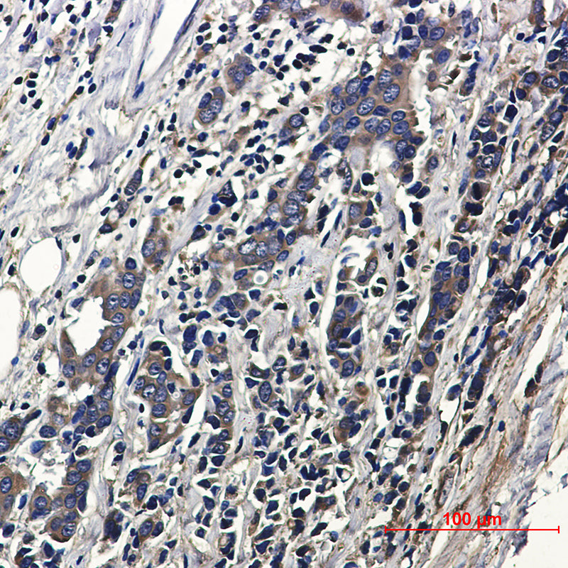 Anti-ACTR1B Rabbit Monoclonal Antibody