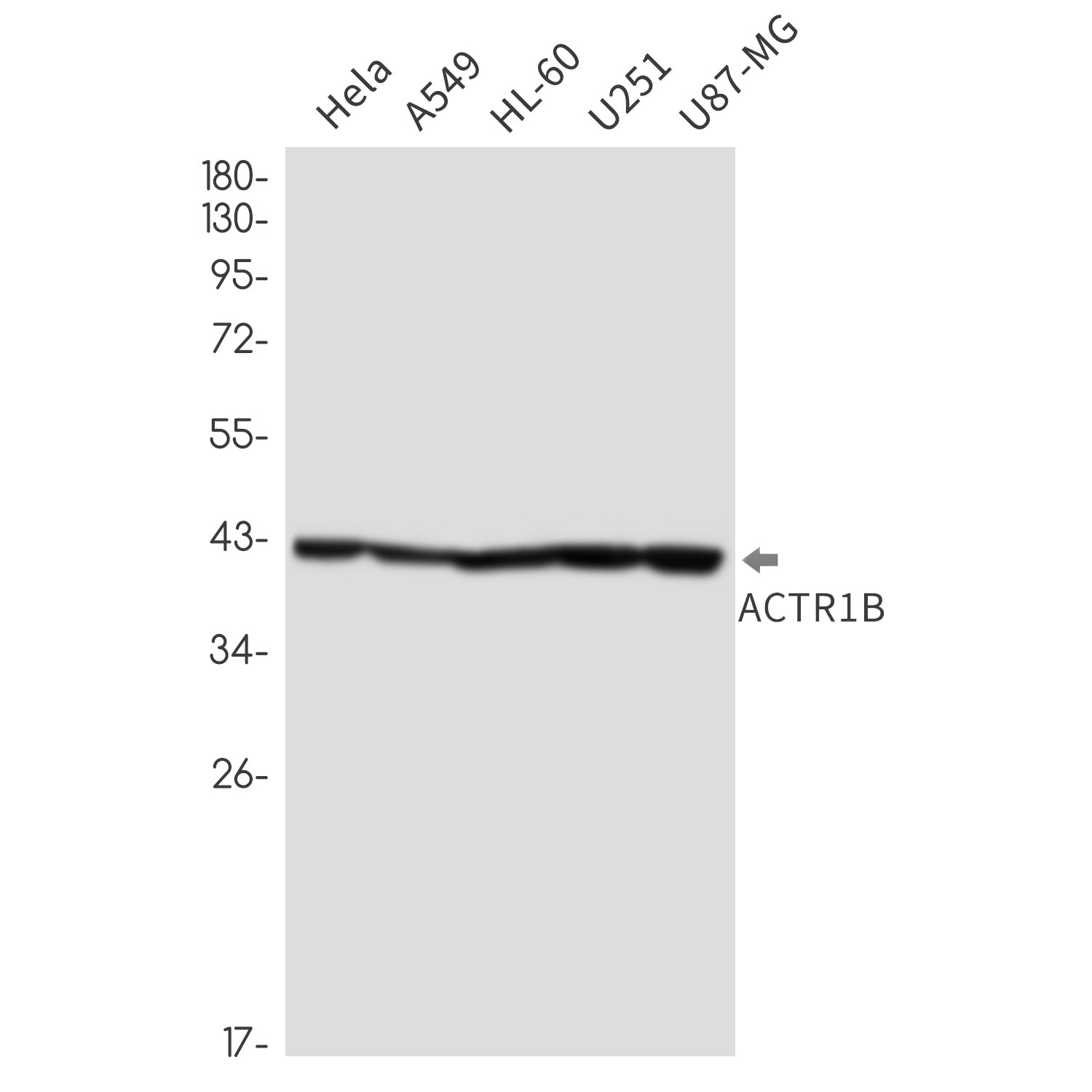 Anti-ACTR1B Rabbit Monoclonal Antibody