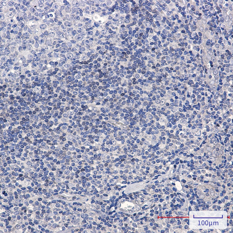 Anti-ADK Rabbit Monoclonal Antibody