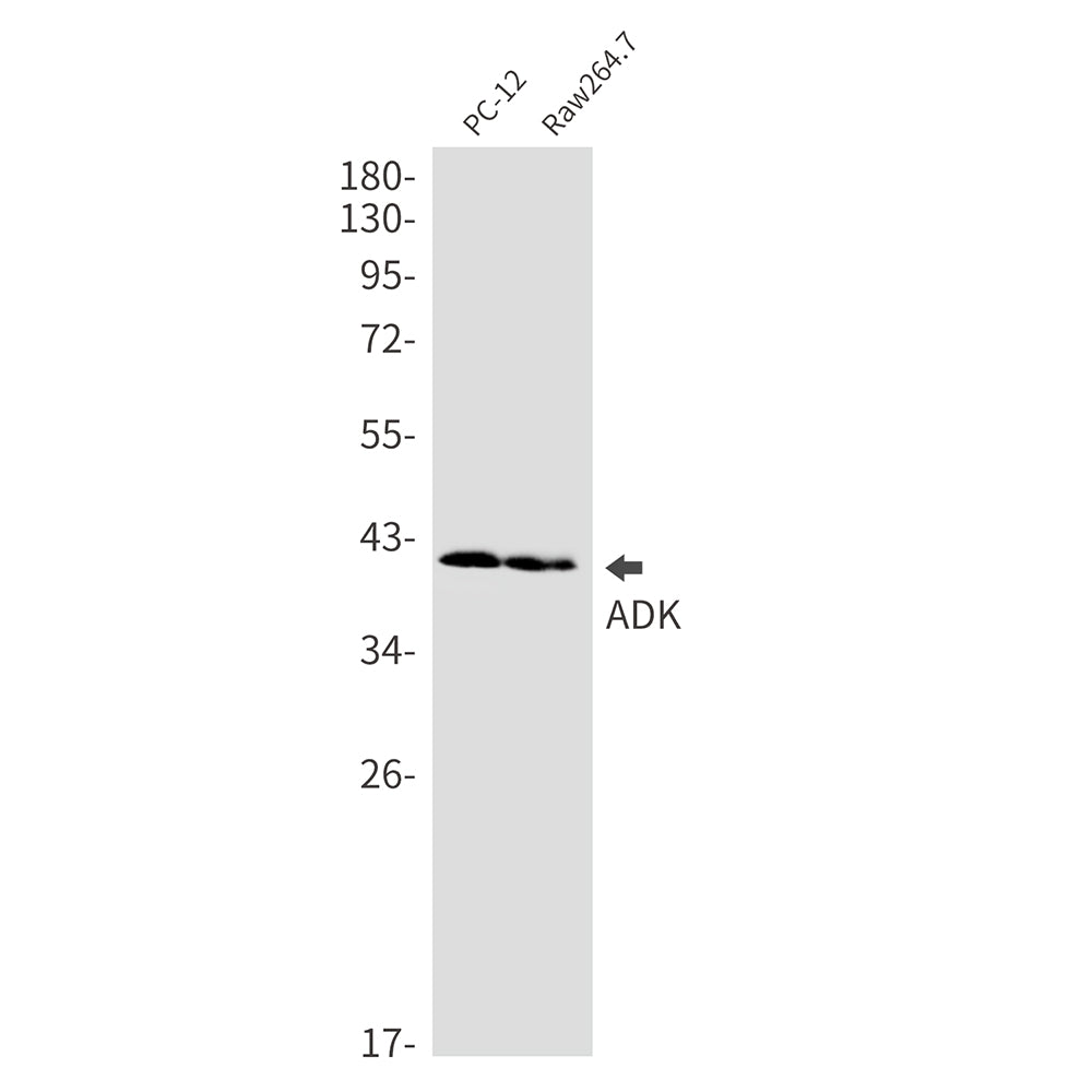 Anti-ADK Rabbit Monoclonal Antibody