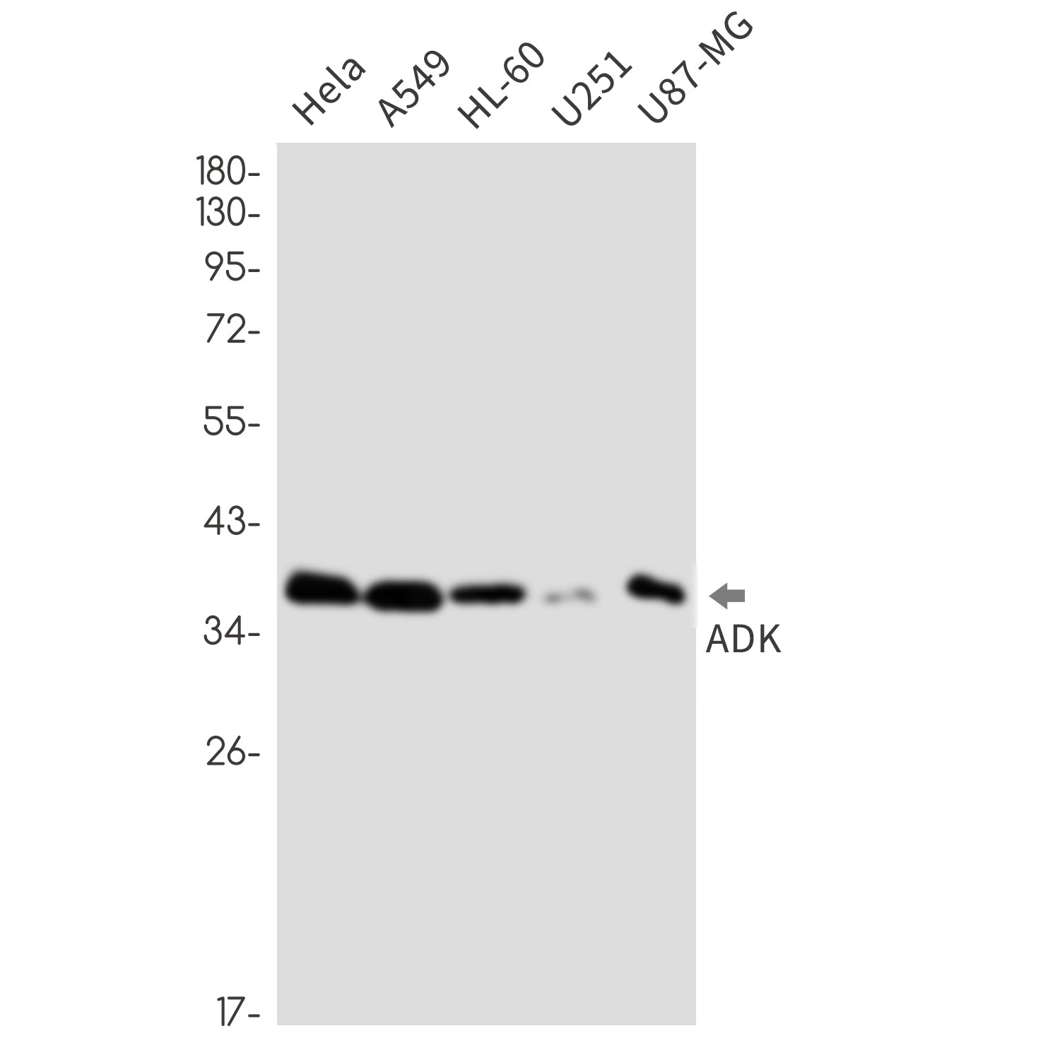 Anti-ADK Rabbit Monoclonal Antibody