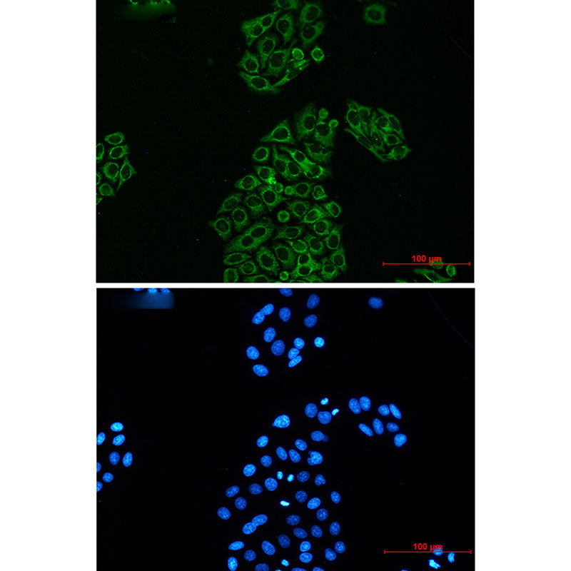 Anti-AK2 Rabbit Monoclonal Antibody