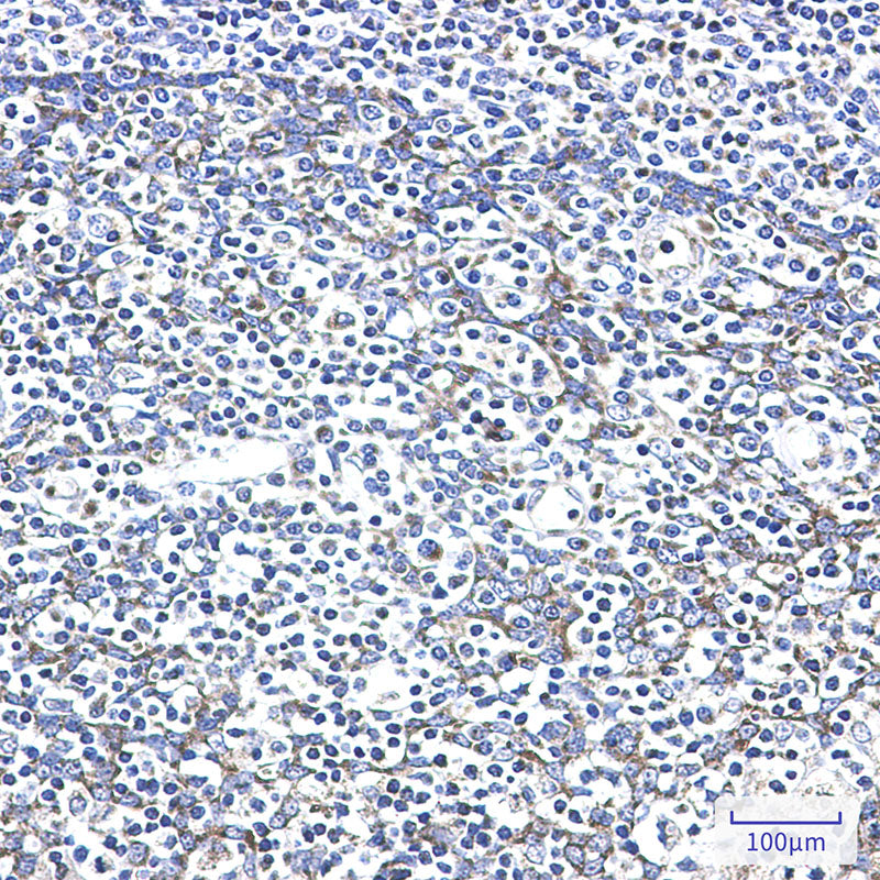 Anti-AK2 Rabbit Monoclonal Antibody