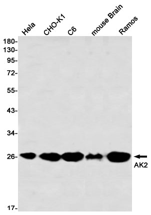 Anti-AK2 Rabbit Monoclonal Antibody