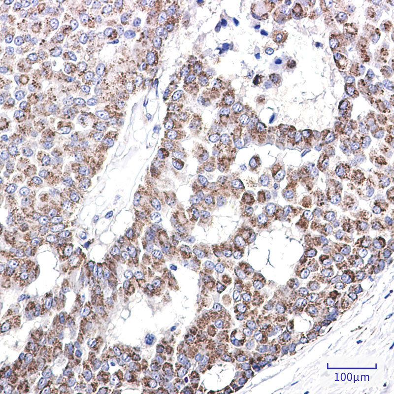 Anti-AK3L1 Rabbit Monoclonal Antibody