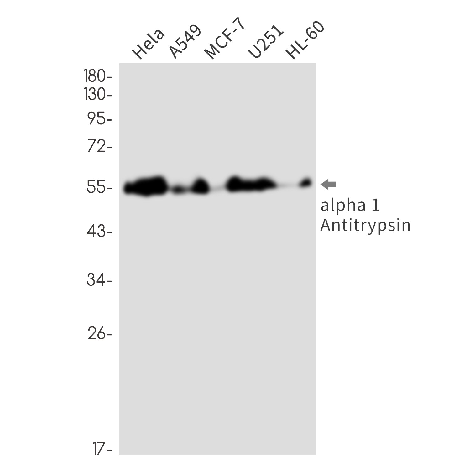 Anti-alpha 1-Antitrypsin Rabbit Monoclonal Antibody
