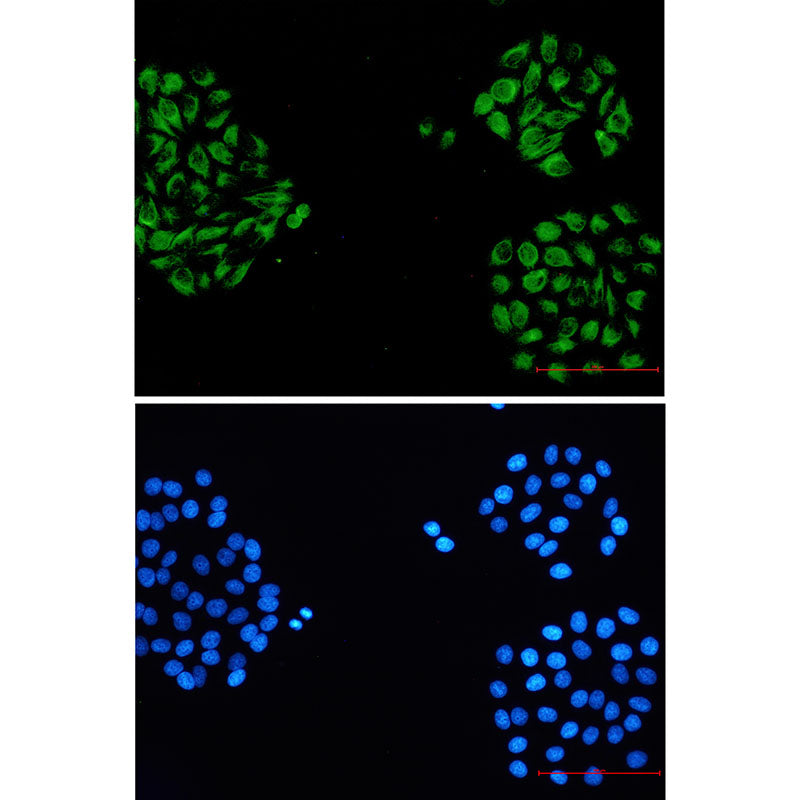 Anti-alpha Internexin Rabbit Monoclonal Antibody