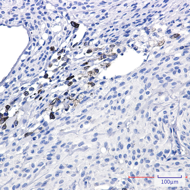 Anti-alpha Internexin Rabbit Monoclonal Antibody