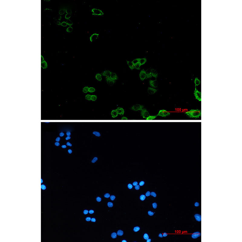 Anti-AMPK gamma 1 Rabbit Monoclonal Antibody