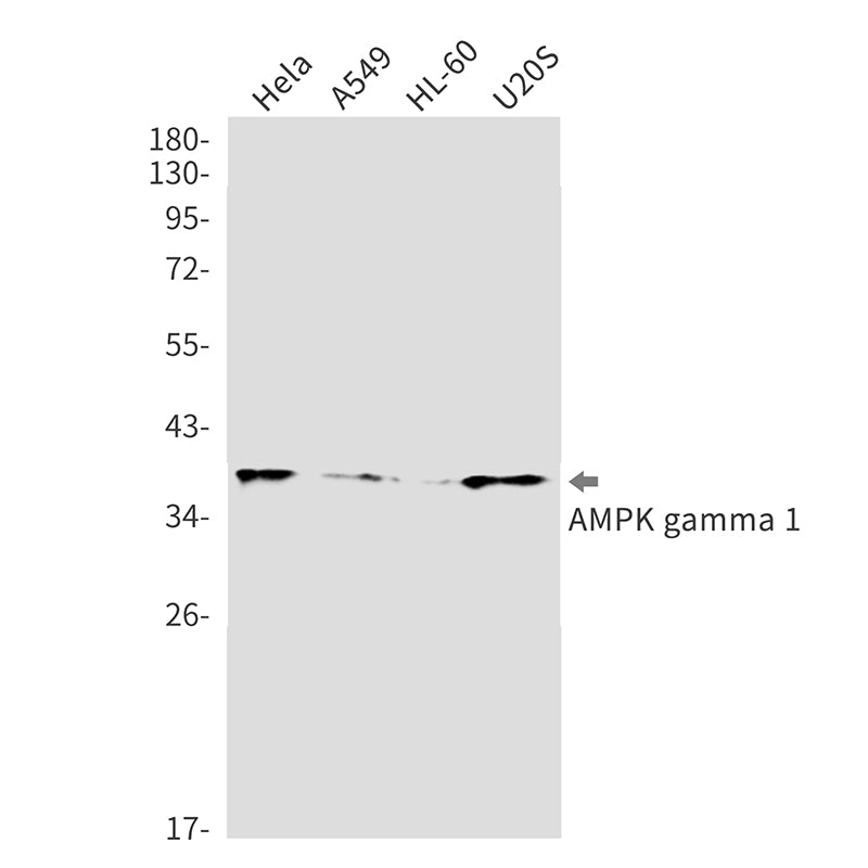 Anti-AMPK gamma 1 Rabbit Monoclonal Antibody