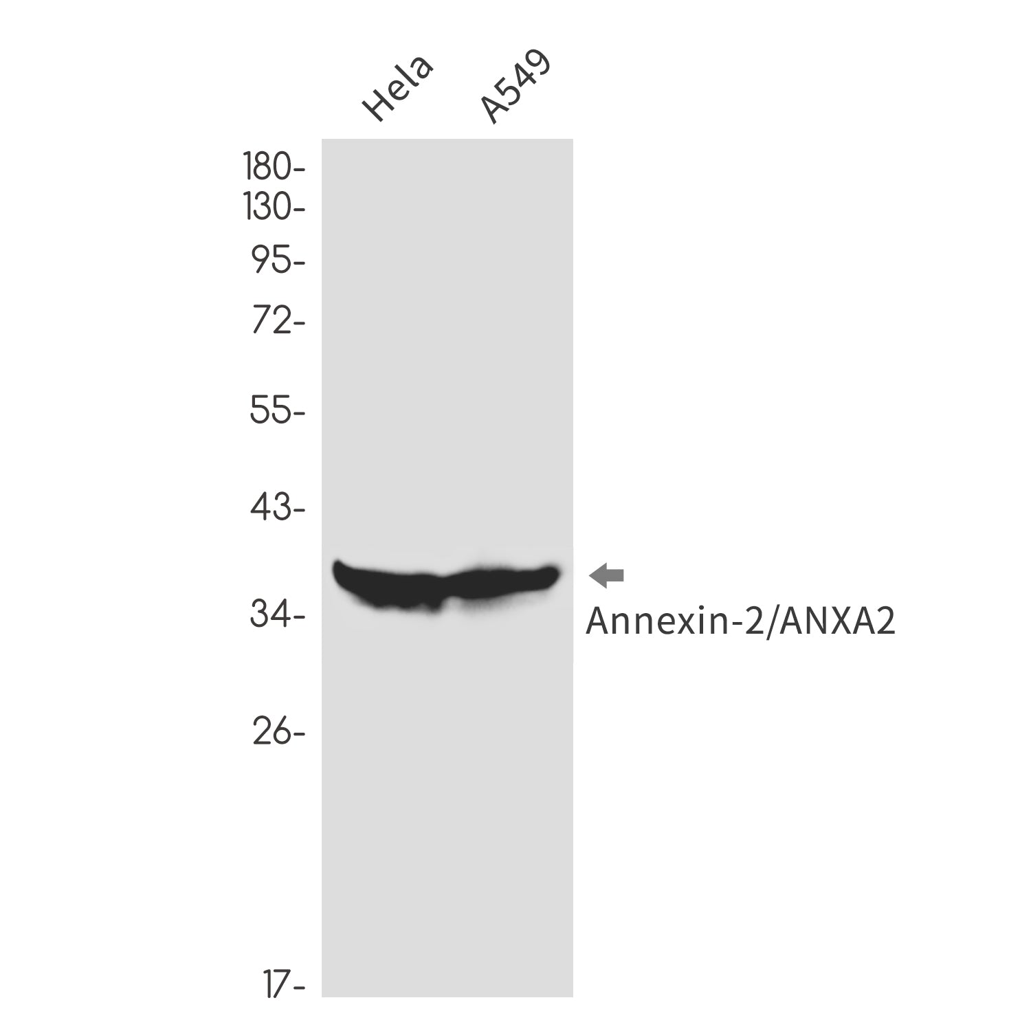 Anti-Annexin 2 Rabbit Monoclonal Antibody