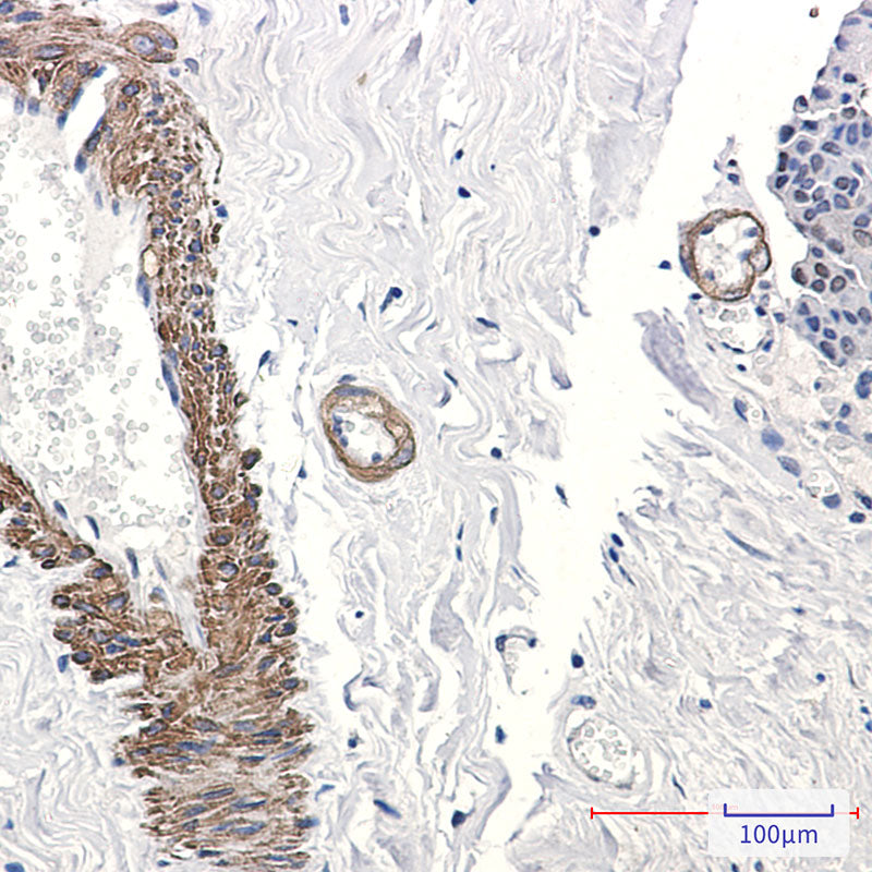 Anti-Transcription Factor AP 2 gamma Rabbit Monoclonal Antibody
