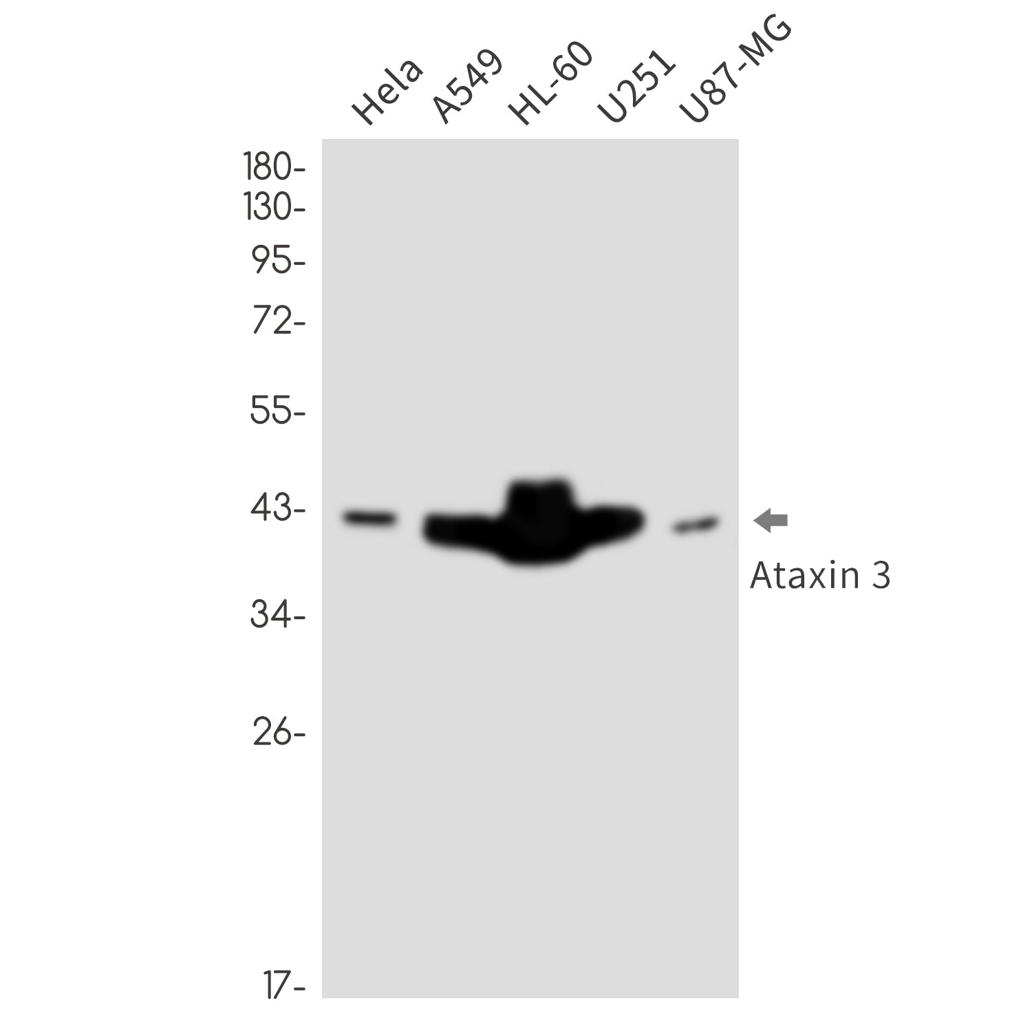 Anti-Ataxin 3 Rabbit Monoclonal Antibody