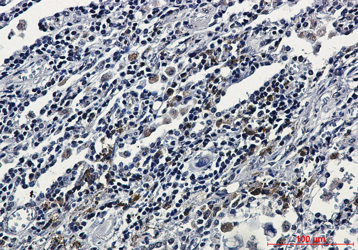 Anti-ATF6 Rabbit Monoclonal Antibody
