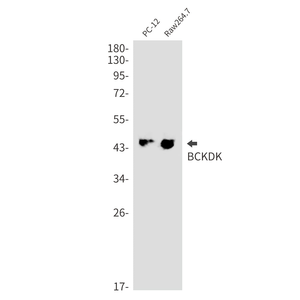 Anti-BCKDK Rabbit Monoclonal Antibody
