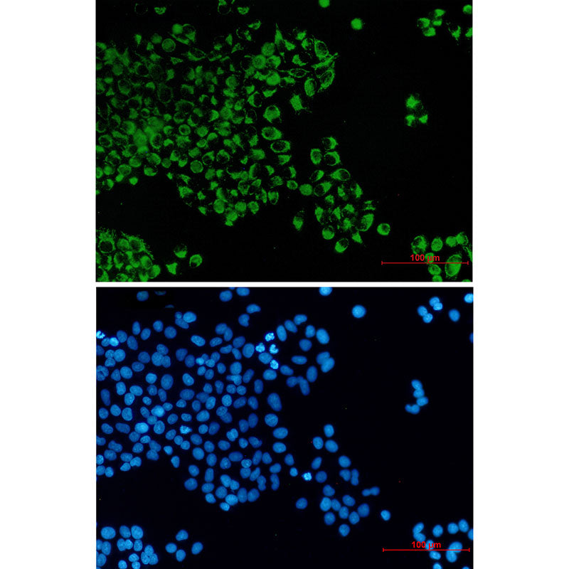 Anti-Bcl2 L14 Rabbit Monoclonal Antibody