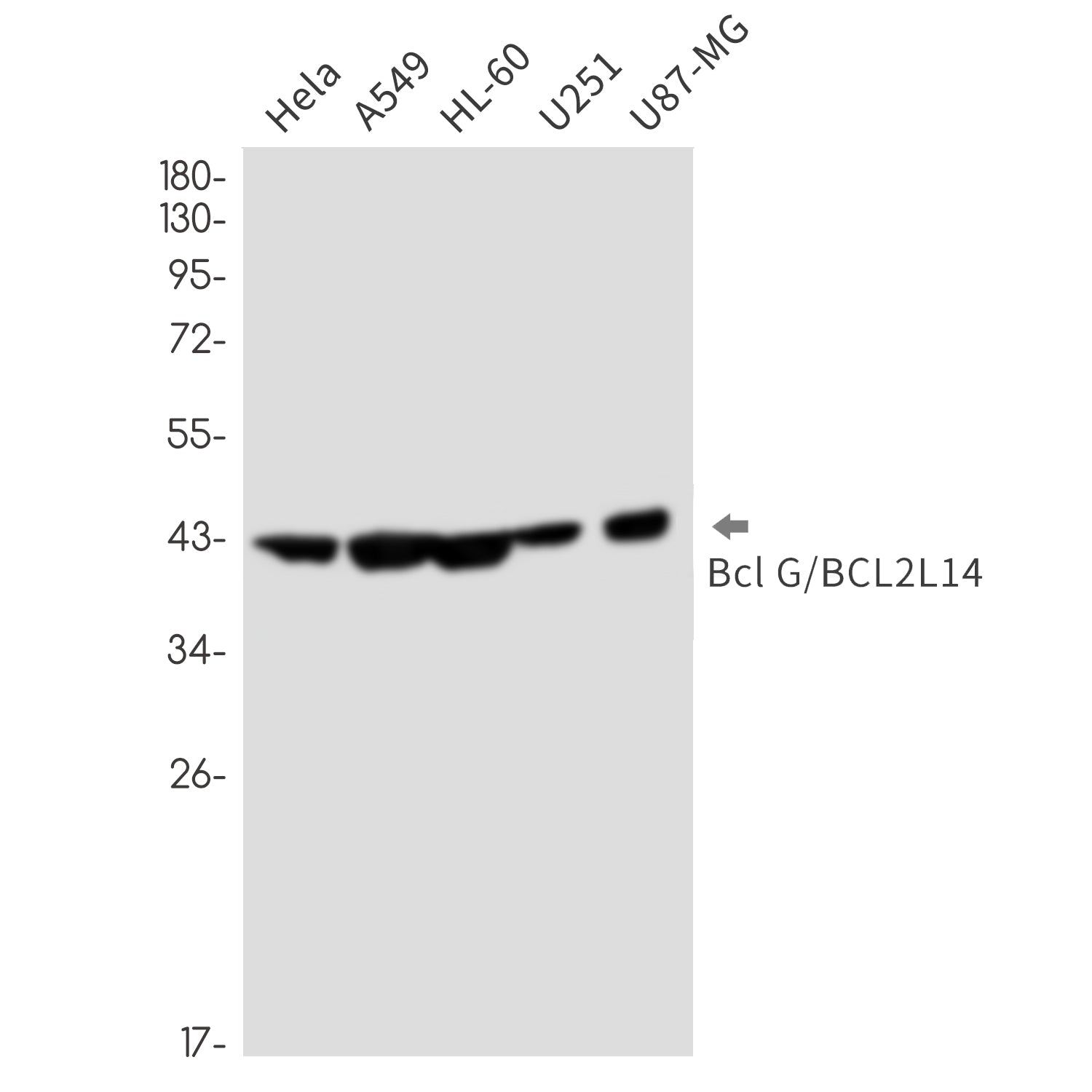 Anti-Bcl2 L14 Rabbit Monoclonal Antibody