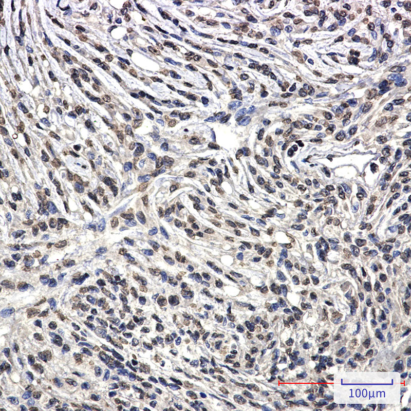 Anti-Bcr Rabbit Monoclonal Antibody
