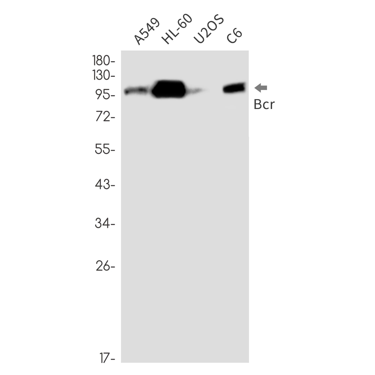 Anti-Bcr Rabbit Monoclonal Antibody