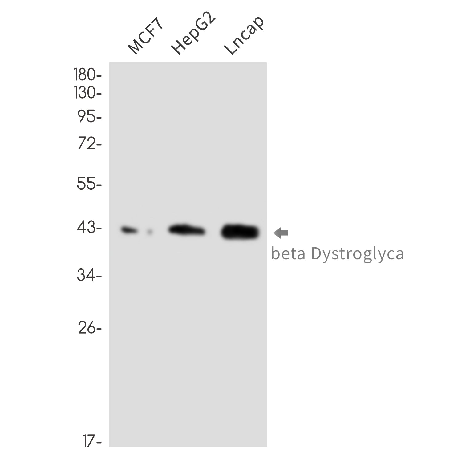Anti-beta Dystroglycan Rabbit Monoclonal Antibody