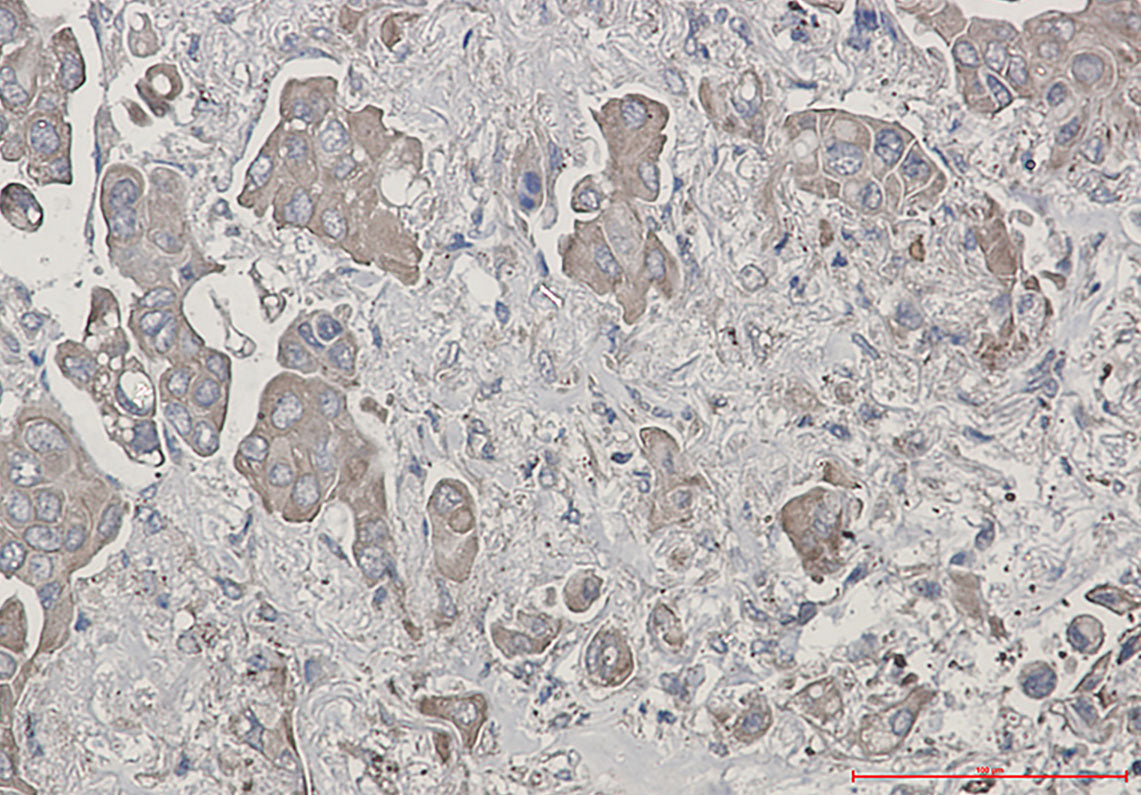Anti-Bid Rabbit Monoclonal Antibody