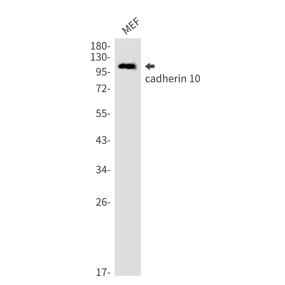 Anti-Cadherin 10 Rabbit Monoclonal Antibody
