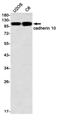 Anti-Cadherin 10 Rabbit Monoclonal Antibody