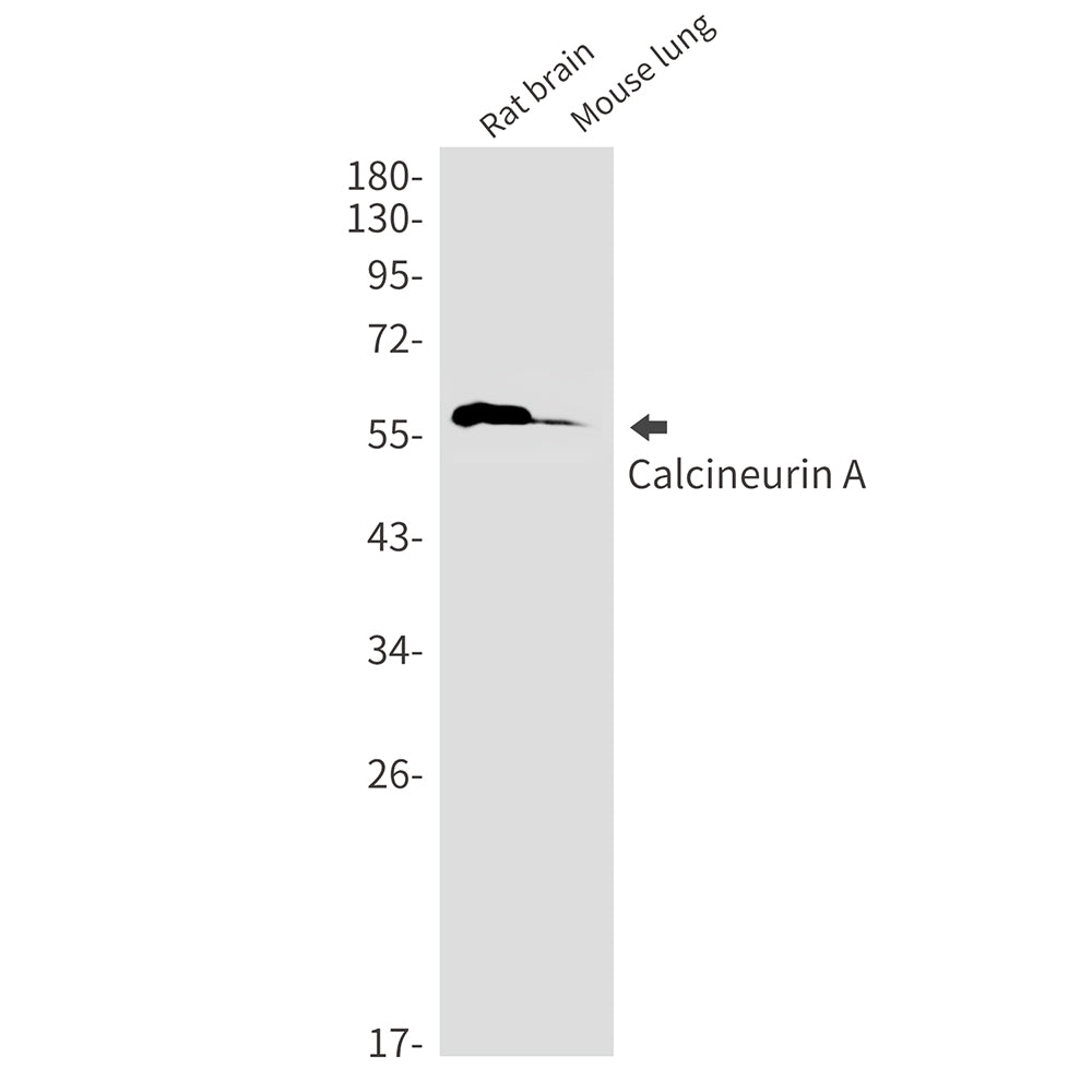 Anti-Calcineurin A Rabbit Monoclonal Antibody