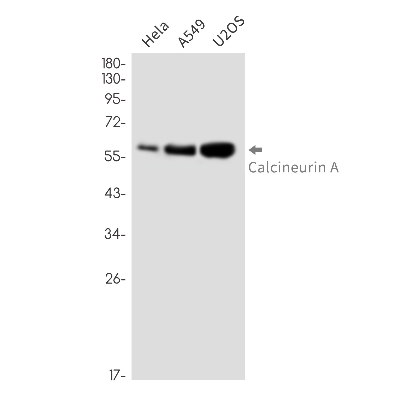 Anti-Calcineurin A Rabbit Monoclonal Antibody