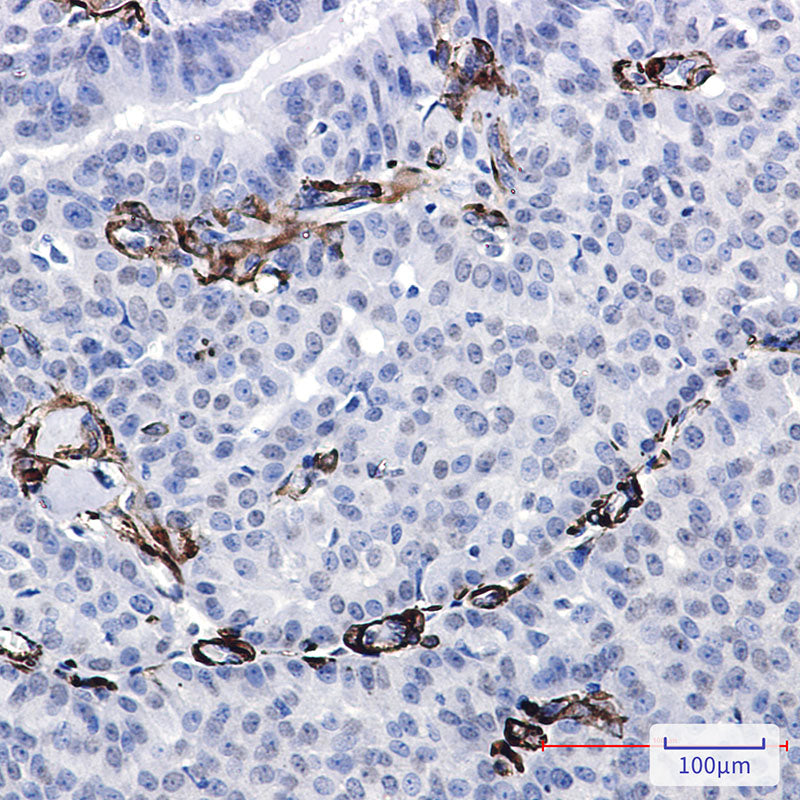 Anti-Caldesmon Rabbit Monoclonal Antibody