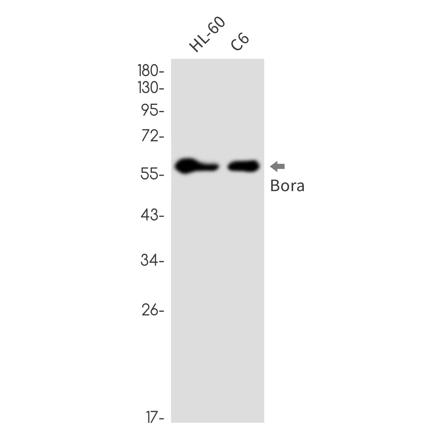 Anti-Caldesmon Rabbit Monoclonal Antibody