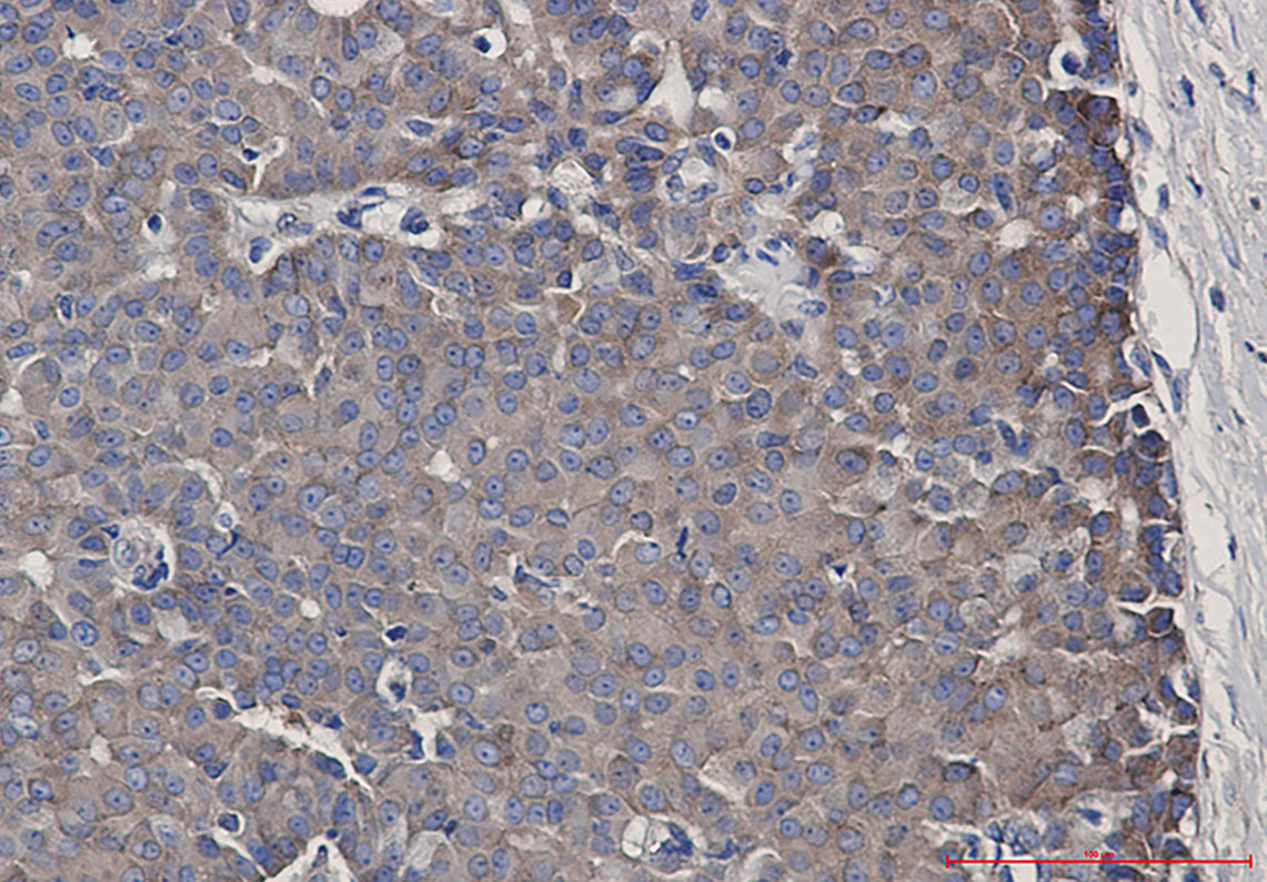 Anti-CARS Rabbit Monoclonal Antibody
