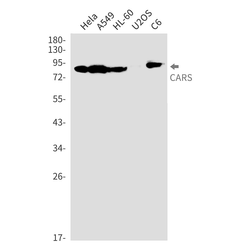 Anti-CARS Rabbit Monoclonal Antibody