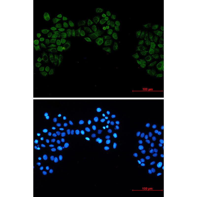 Anti-Casein Kinase 2 beta Rabbit Monoclonal Antibody
