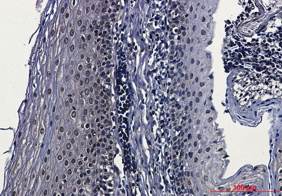 Anti-Casein Kinase 2 beta Rabbit Monoclonal Antibody