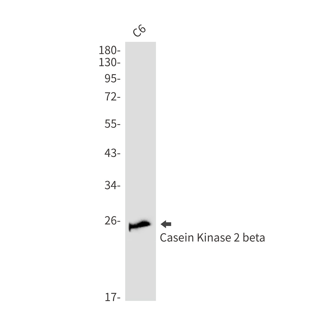 Anti-Casein Kinase 2 beta Rabbit Monoclonal Antibody