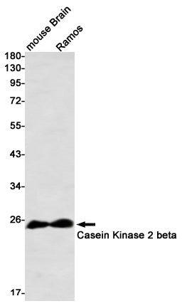 Anti-Casein Kinase 2 beta Rabbit Monoclonal Antibody